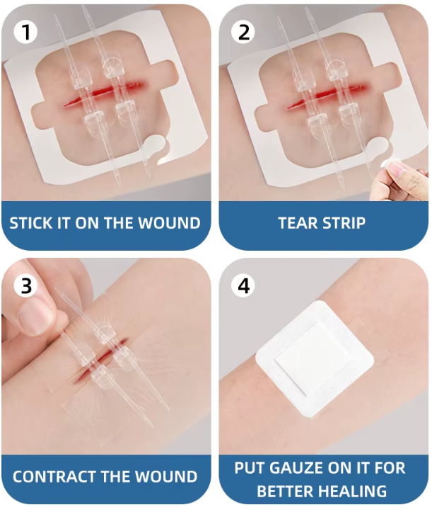 HealZip®: Menos dolor, más comodidad en emergencias.